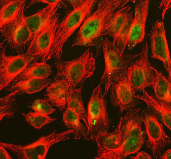 Immunofluorescent staining of FFPE human U-2 OS cells with ALKBH1 antibody (green) and Alpha Tubulin