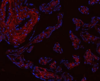 Collagen I Antibody / COL1A1