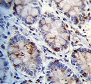 C1QC Antibody