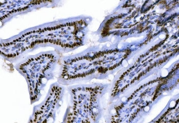 C-terminal-binding protein 2 Antibody / CTBP2