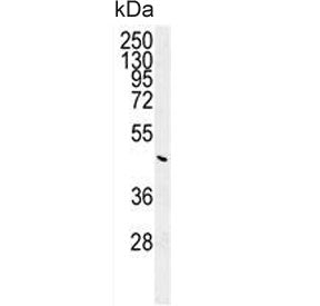 Western blot testing of human K562 cell lysate with G6PC antibody. Predicted molecular weight ~41 kD