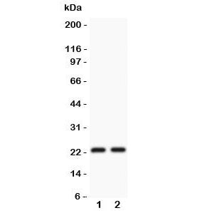 Western blot testing of CD3 epsilon antibody and Lane 1: Jurkat; 2: CEM lysate. Expected/observed mo