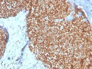 Estrogen Receptor alpha Antibody