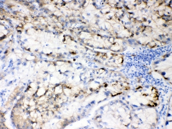 Hepatitis B Virus Antibody (Large S Protein)