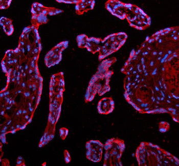 Immunofluorescent staining of ADAM12 using anti-ADAM12 antibody (red). ADAM12 was detected in a para