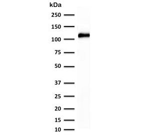 Western blot testing of human kidney lysate with recombinant Cadherin 16 antibody (clone KSCP2-2R). 
