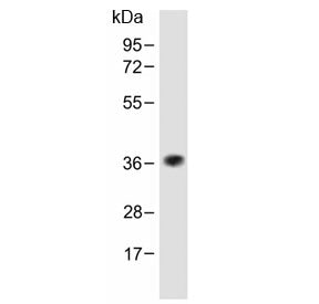 Western blot testing of human skeletal muscle lysate with TAS2R5 antibody at 1:1000. Predicted molec