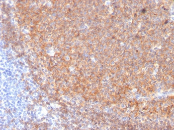 IHC staining of FFPE human tonsil with CD19 antibody (clone CD19/3117). HIER: boil tissue sections i