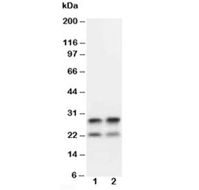 Western blot testing of MBP antibody and mouse brain tissue lysate. Multiple isoforms may be visuali