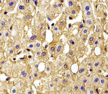 IHC testing of FFPE human liver tissue with Hemoglobin subunit gamma-2 antibody. HIER: steam section