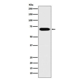 Western blot testing of human HeLa cell lysate with PRC1 antibody. Expected molecular weight ~70-80 