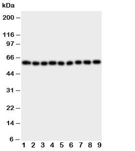 Western blot testing of IL5RA antibody and Lane 1: A549; 2: SMMC-7721; 3: U87; 4: 293T; 5: PANC; 6: 