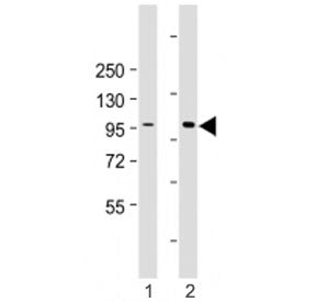 Western blot testing of HACE1 antibody at 1:2000: Lane 1) human HEK293 and 2) 293T/17 cell lysate. P