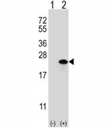Western blot analysis of Claudin 1 antibody and 293 cell lysate either nontransfected (Lane 1) or tr
