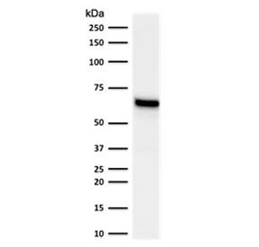 Western blot testing of human MCF-7 lysate with Estrogen Receptor alpha antibody (clone NR3Ga-2). Ex