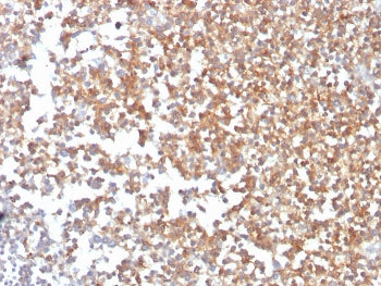 CD10 Antibody / Neprilysin