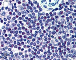 HMG20A Antibody