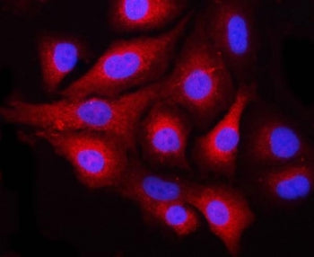 NEK6 Antibody / NimA-related protein kinase 6