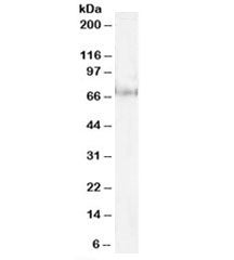Western blot testing of HeLa lysate with Pescadillo antibody at 1ug/ml. Predicted/observed molecular