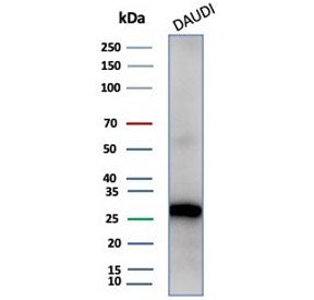 Haptoglobin Antibody