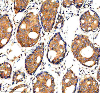 Immunohistochemical staining of ADAMTS1 using anti-ADAMTS1 antibody. ADAMTS1 was detected in a paraf