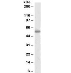 Western blot testing of human cerebral cortex lysate with Tyrosine Hydroxylase antibody at 2ug/ml. P