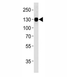 Integrin beta 1 Antibody (ITGB1)