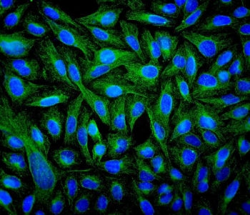 IF/ICC staining of FFPE human U-2 OS cells with Beta Tubulin antibody (green) at 2ug/ml and DAPI nuc