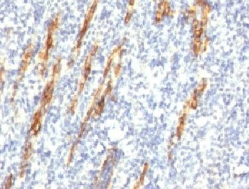 IHC: Formalin-fixed, paraffin-embedded human tonsil stained with CD34 antibody (QBEnd/10 + HPCA1/763