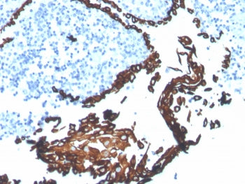 IHC staining of FFPE human tonsil tissue with CK5 antibody (clone KRT5/7500R). HIER: boil tissue sec