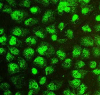 IF/ICC staining of FFPE human A431 cells with SOX15 antibody at 2ug/ml. HIER: steam section in pH6 c