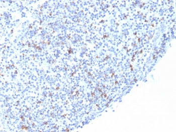 Integrin alpha E Antibody / CD103