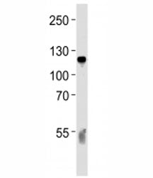 Western blot analysis of lysate from human blood plasma tissue lysate using C6 antibody diluted at 1