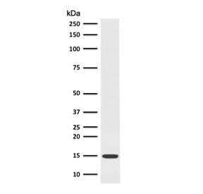 Western blot testing of Fascin antibody and human HepG2 cell lysate (clone FDAX-1). Expected molecul
