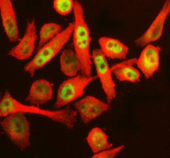 Immunofluorescent staining of RERE using anti-RERE antibody (green) and anti-Beta Tubulin antibody (