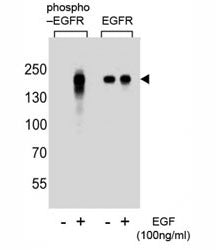 Phospho-EGFR Antibody (pY1172)