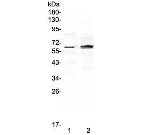 Western blot testing of human 1) placenta and 2) MCF7 lysate with FZD4 antibody at 0.5ug/ml. Predict