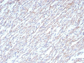IHC staining of FFPE human heart tissue with Cadherin 2 antibody (clone CDH2/8862R). HIER: boil tiss