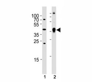 Zebrafish Ada Antibody