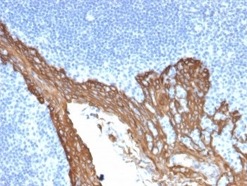 IHC staining of FFPE human prostate with Cytokeratin 8 antibody (clone KRT8/2115). HIER: boil tissue