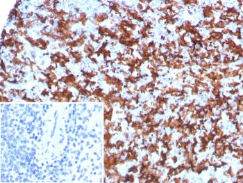 IHC staining of FFPE human spleen tissue with Allograft inflammatory factor 1 antibody (clone AIF1/8