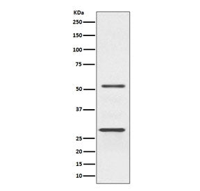 Western blot testing of human Jurkat cell lysate with PARK2 antibody. Expected molecular weight: 50-