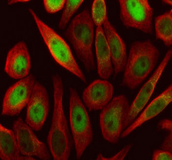 Immunofluorescent staining of FFPE human SiHa cells with SKP2 antibody (green) and Alpha Tubulin mAb