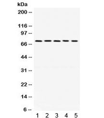 LIM Kinase 1 Antibody / LIMK1