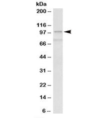 Western blot testing of human spleen lysate with ACTN1 antibody at 0.3ug/ml. Predicted molecular wei
