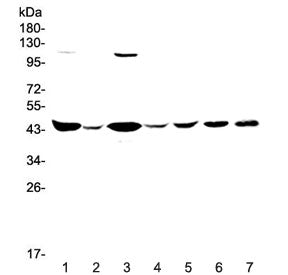 Western blot testing of human 1) HeLa, 2) placenta, 3) COLO-320, 4) SW620, 5) MDA-MB-231, 6) rat bra