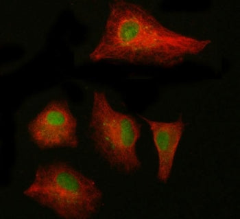Immunofluorescent staining of FFPE human A549 cells with NAB1 antibody (green) and Beta Tubulin mAb 