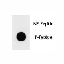 Dot blot analysis of phospho-TSC2 antibody. 50ng of phos-peptide or nonphos-peptide per dot were spo