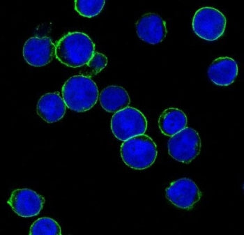 HER2 Antibody / ErbB2