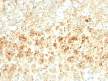 IHC testing of FFPE human adrenal tissue with recombinant Adipophilin antibody (clone ADFP/2755R). R